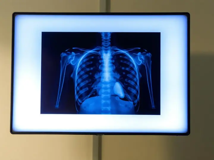 Digital X-Ray